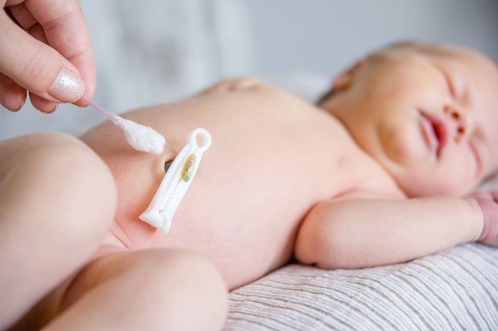 Cách vệ sinh rốn của bé sạch sẽ vào mùa hè Cách vệ sinh rốn của bé sạch sẽ vào mùa hè